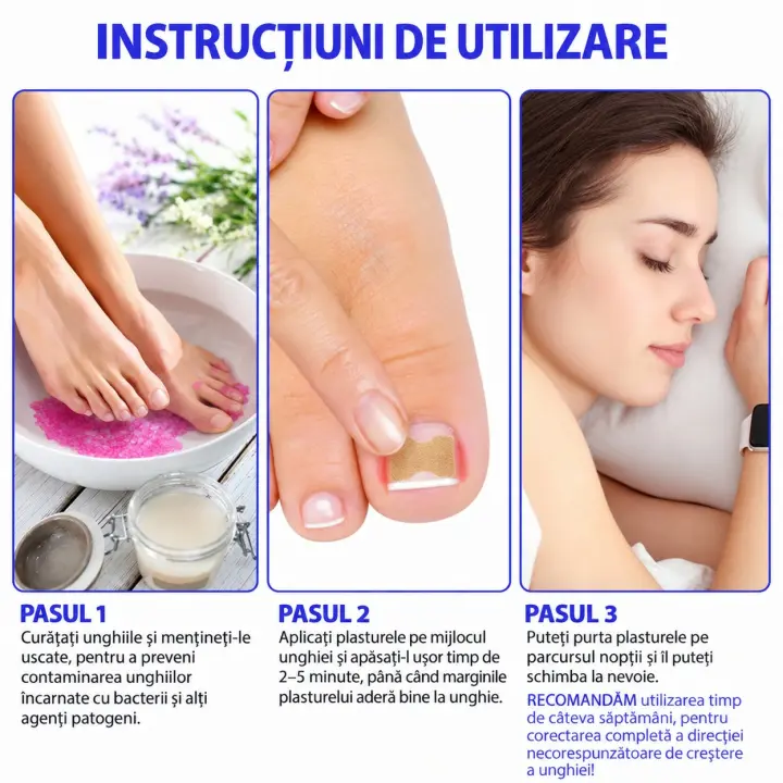 Plasturi pentru unghii incarnate 10 buc